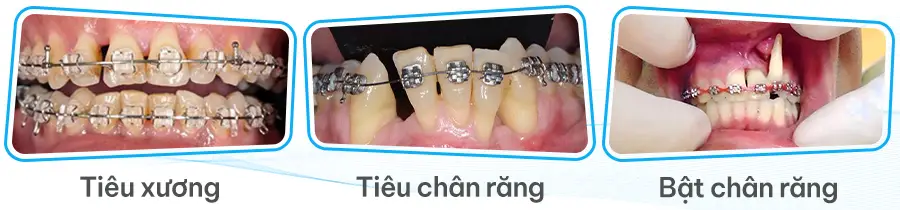 3bienchung