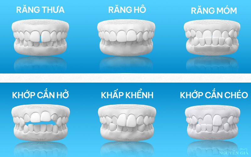 6 saikhopcan 1