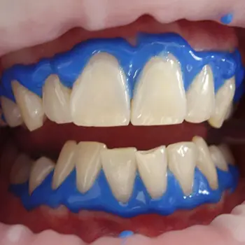Bước 2: