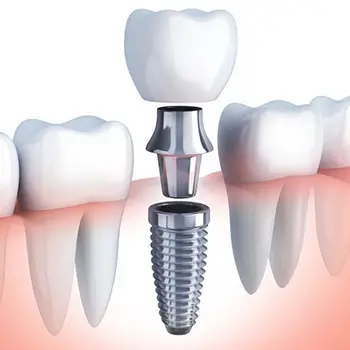Bước 4: