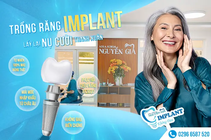 slidemain implant