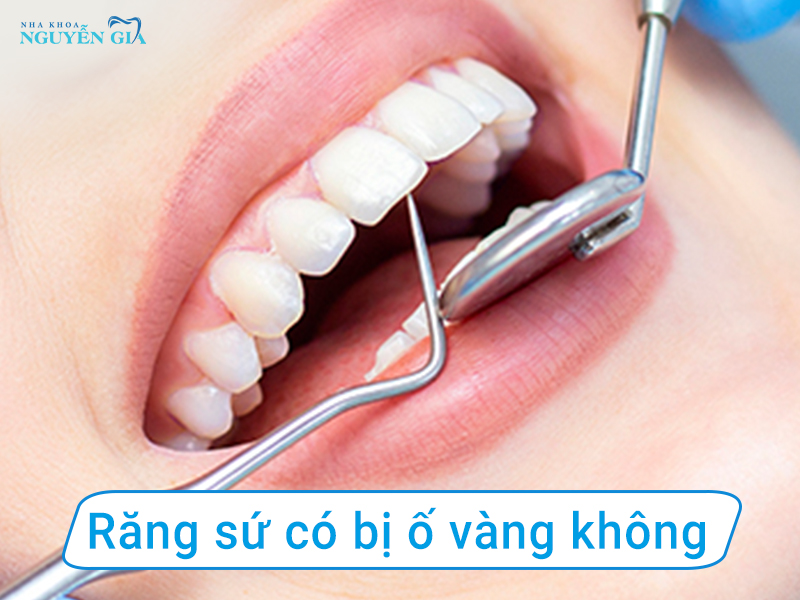 rangsucobiovangkhong