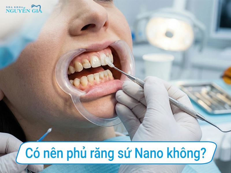 co nen phu su nano khong