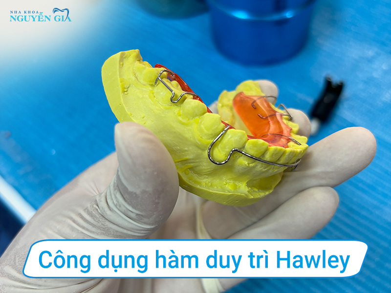 ham duy tri hawley co tot khong